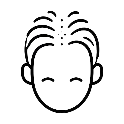 Hair Thinning