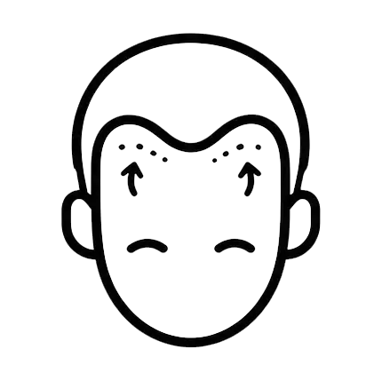 Receding Hairline